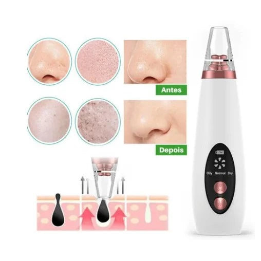 Removedor De Cravos Espinhas Cleaning Sugador Poros Acne Sucção Usb Recarregável